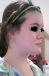 Taken at a semi-side angle where I feel features are most prominent/uncomplimentary.