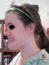 Taken at a semi-side angle where I feel features are most prominent/uncomplimentary.