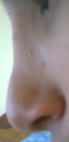 9 Months After