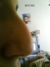 Before