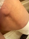 This is my inner left thigh.