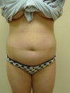 After Front