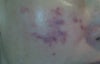 picture of cheek