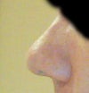 Side shot of my nose