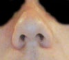 Front shot of my nose