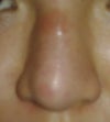 front view.
