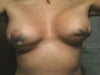 with sontration of muscle