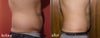 before-after side