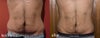before-after front