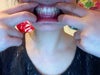 this is a picture of my teeth without the aligners in