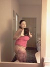 one week post op