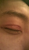 Right eye