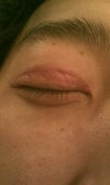 Right eye