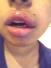 my lips today 10/4/2011