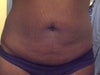 I am 5'8" and weigh 160 lbs. I have 3 children and am interested in shrinking my mid section