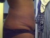 loose skin but could stand to lose more fat in the midsection