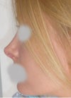 Looks a bit too curved than I would have liked. Is this from swelling in the tip? Will the tip drop a bit with time and give a straighter appearance? The tip looks too 'pulled up' to me from this angle?