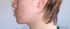 jaw left side