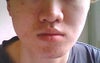 front mouth closed