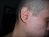 Right ear, normal.
