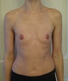 Frontal view