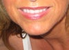 My natural smile...nothing done.