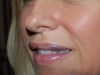 Jan 4, 2010 lip injected Pic 1