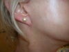 right earlobe
