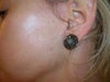 left earlobe
