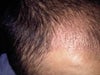 these are the bumps but u cant see the ridging effect.