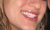 my old smile