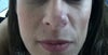 Front view of the nose - pink & swollen.