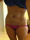 from the front bending (disregard the psoriasis I have)