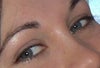 Full smile in 2009. Note no eyelid folds, no excess skin, no bags. Skin was a healthy colour & all the same tone.