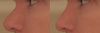 Left - Current Nose
Right - Morph
