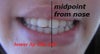 smile, asymmetrical