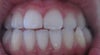 only teeth