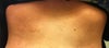 showing ribs- my left side is swollen