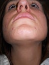 chin/jaw/mouth area