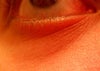 Right eye