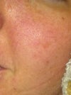 Side of face...