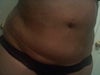 Two days after surgery