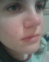 after the hit