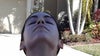 6 week post-op nostril view