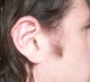 Right ear