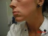Side flat cheeks