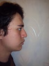 BEFORE PROFILE