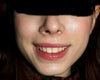 I've also had rhinoplasty for a crooked nose, but the asymmetry of the jaw seems more prevalent.