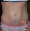 This is my before shot, it may not look like it, but when bent over my skin would hang from my body.