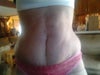This is one of my after shots